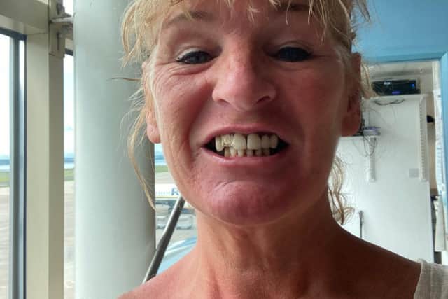 Sally Murphy made the decision to fly to Turkey for a dental operation saying it would cost more than £19,000 to get it done in the UK after being unable to get an NHS.