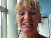 Sally Murphy made the decision to fly to Turkey for a dental operation saying it would cost more than £19,000 to get it done in the UK after being unable to get an NHS.