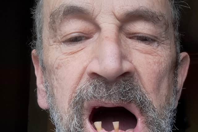 A grandfather removed his own teeth as he couldn’t see an NHS dentist. Image: George Glinos/SWNS