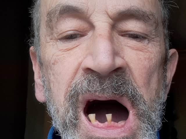 A grandfather removed his own teeth as he couldn’t see an NHS dentist. Image: George Glinos/SWNS
