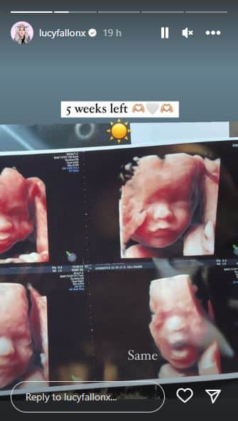 Lucy Fallon shared a 3D baby scan (Instagram/lucyfallonx)