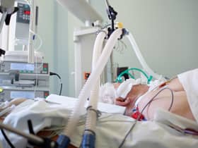A patient with coronavirus pneumonia in a critical state. Image: Kiryl Lis - stock.adobe.com