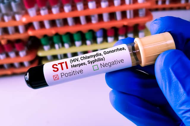 New research suggests the existence of an STI hotspot in the North West’s largest cities, including Manchester, Liverpool and Salford. Photo: Adobe Stock/Saiful52