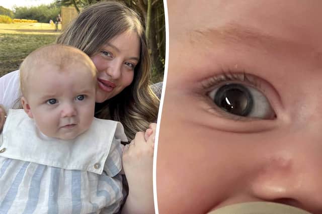 A mum who thought her baby's "wonky" right eye was "adjusting" found out it was a sign of a rare cancer.