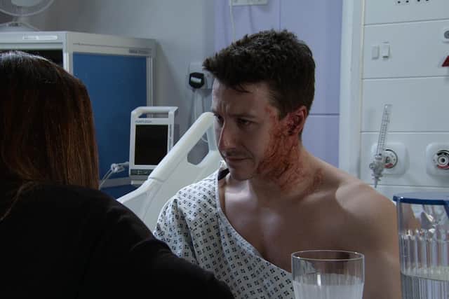 Ryan was left with severe burns after evil Justin Rutherford threw acid at him (Photo: ITV)