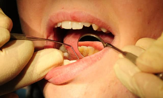 The British Dental Association said the pandemic has exacerbated longstanding problems in NHS dentistry